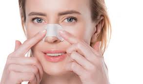 اسپیلنت پروانه ای